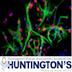 Huntington's Disease Association (Auckland) Inc's avatar