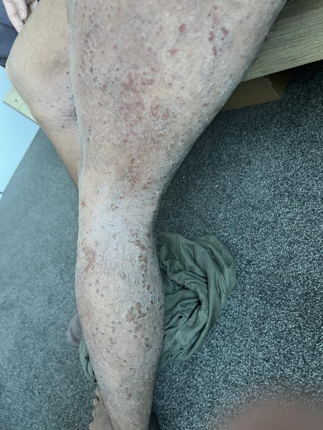 Update image