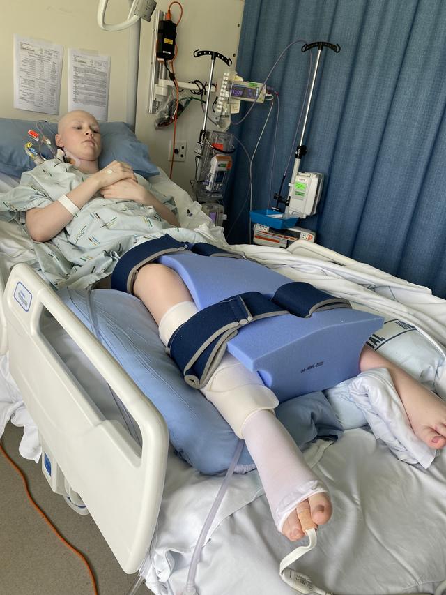 Update image