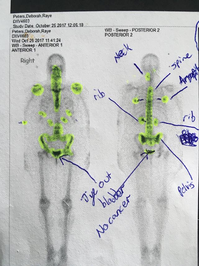 Update image