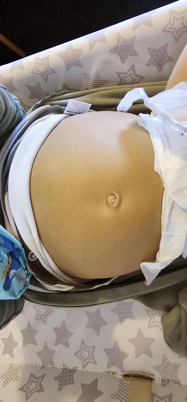 Update image