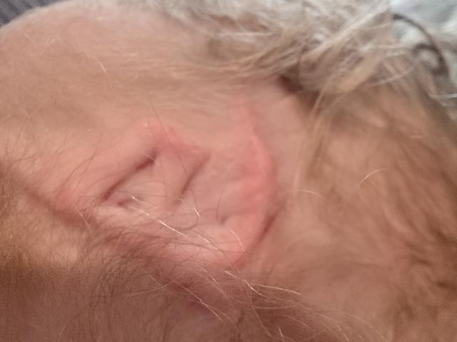 Update image