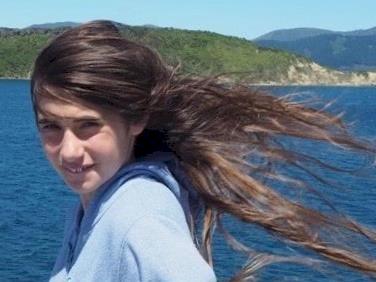 Eleanor's Losing HER hair