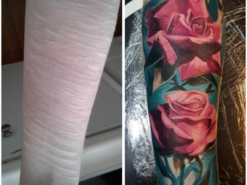 scar coverup  Tattoos to cover scars, Cover tattoo, Scar tattoo