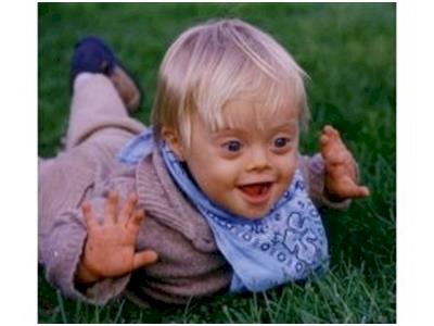 Give some sugar for down syndrome!