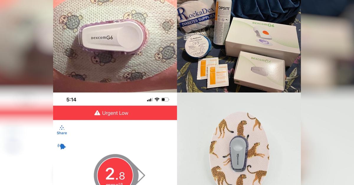 Help needed to replace stolen g6 Sensors Givealittle