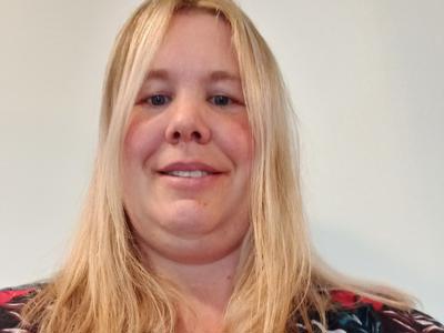 Skin removal from losing 40kg of weight