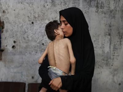 75 Days of Purpose – Standing with Gaza!