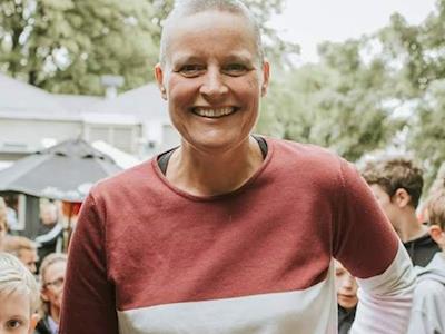 Diana Conner sheds "dead tissue" to raise cancer research funds!