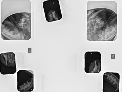 Liana Major dental surgery