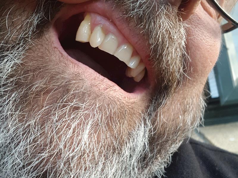 My Teeth are falling out. - Givealittle