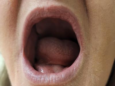 Life's unbearable without teeth