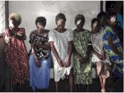 Saving Sight in Papua New Guinea