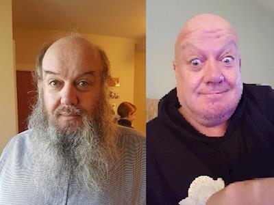 All of Colins Head Hair gone for Arlo