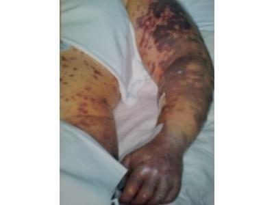 Tough guy and gal Mud Run for a Mum!