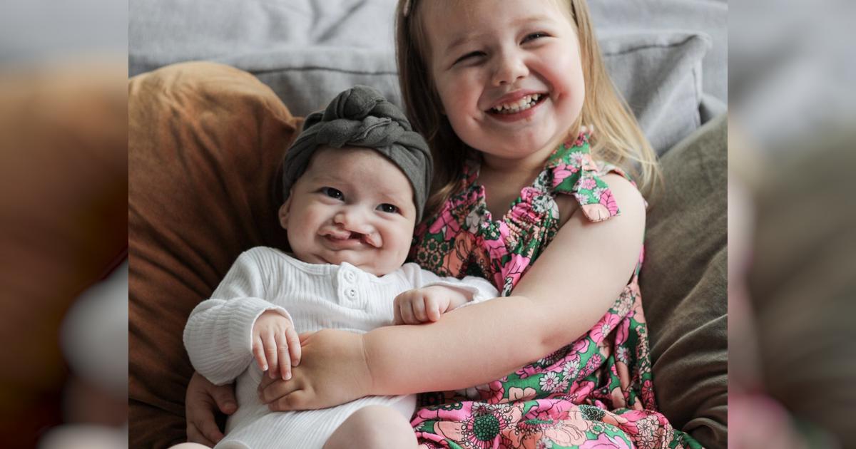 Gloves Up for Smiles Supporting Waikato Hospitals Cleft Team Givealittle