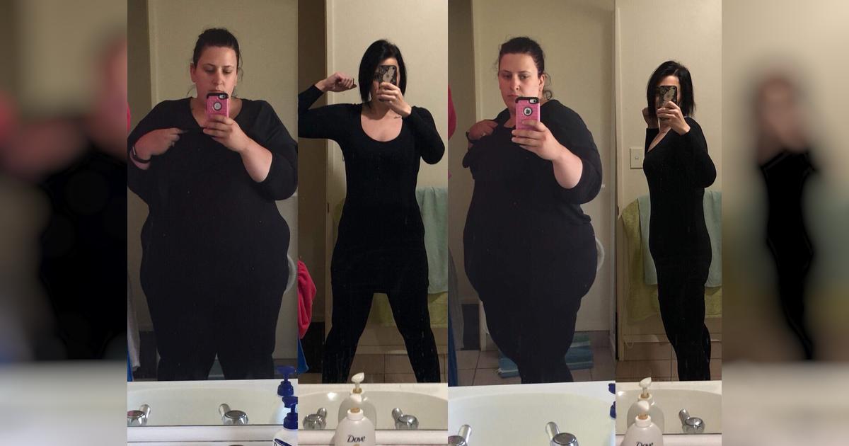 Amanda’s surgery - Givealittle