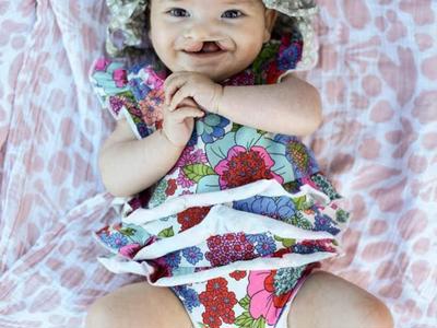 Supporting Little Heroes:Join Me in Empowering Cleft Families!