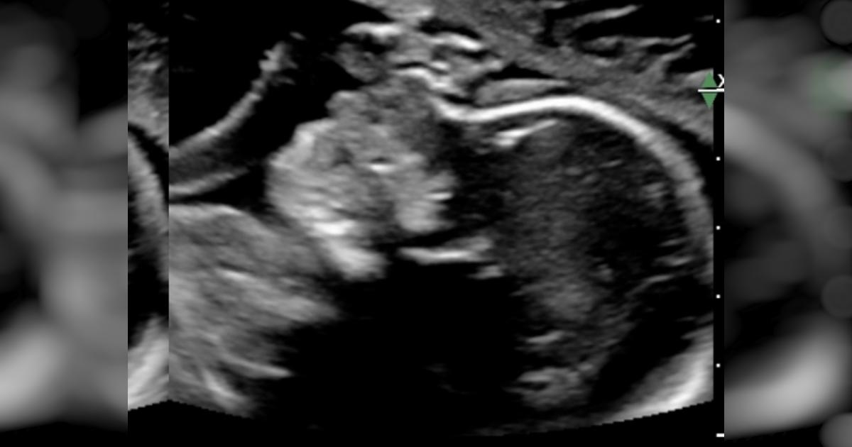 Supporting baby Mauri and family - Help give him the best start ...