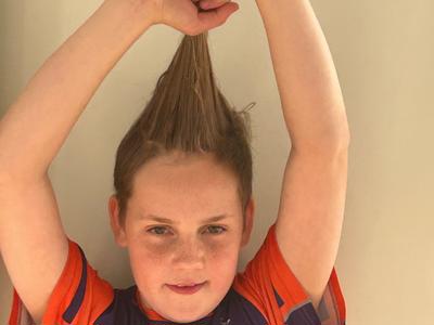 Shaving hair to support gut cancer research