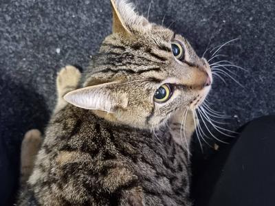 Sylvester needs leg amputation