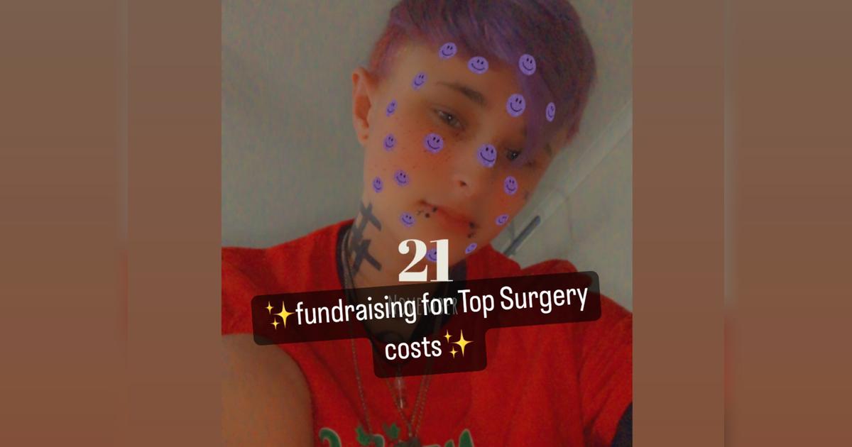 Jakes FTM Top Surgery Givealittle