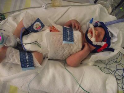 Run4CJ - forever raising $ for Middlemore’s NICU